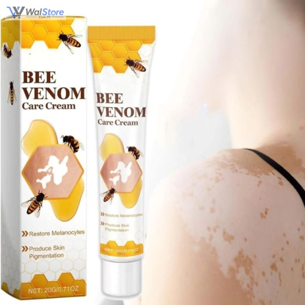 Vitiligo Bee Venom Treatment Cream In Pakistan thumbnail 2