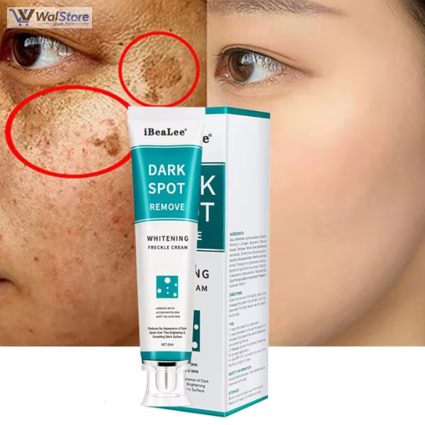 IBealee Dark Sport Remove Whitening Freckle Cream Price In Pakistan thumbnail 2