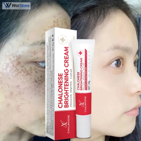 Chalonese Brightening Cream Price In Pakistan thumbnail 2