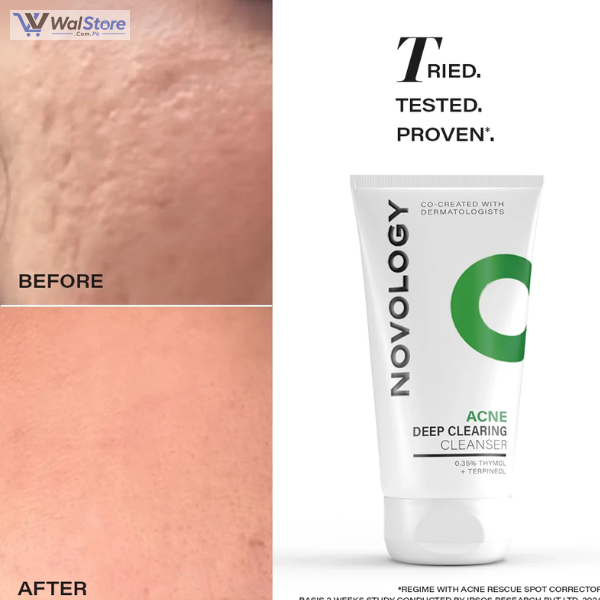 Novology Acne Rescue Spot Corrector Gel in Pakistan thumbnail 2