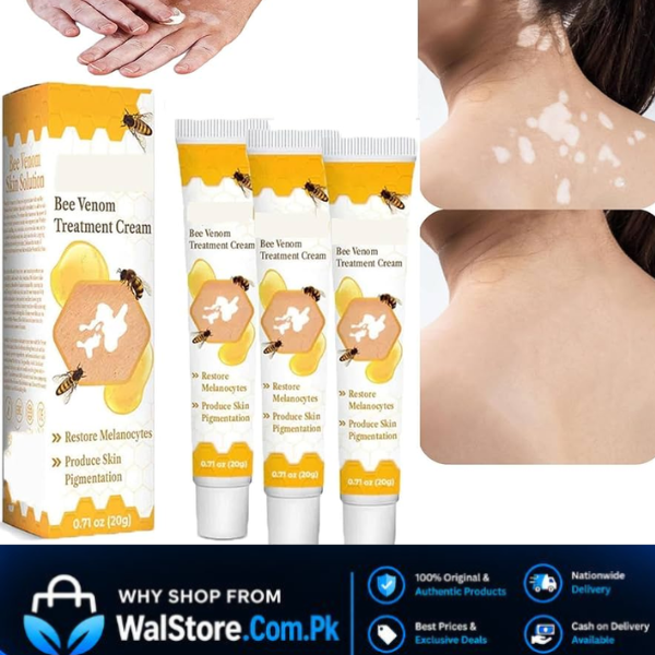 Vitiligo Bee Venom Treatment Cream In Pakistan thumbnail 3