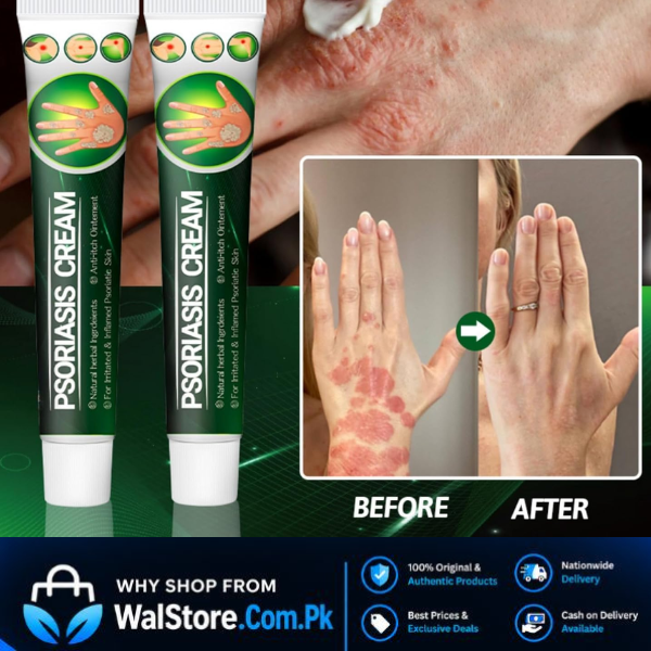 PSORIASIS Ointment In Pakistan thumbnail 3