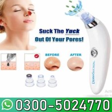 4 in 1 High Quality Black Head Remover Derma Suction