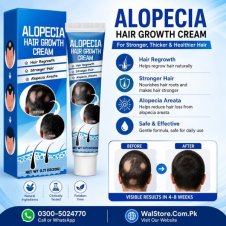 Alopecia Hair Growth Cream Price in Pakistan
