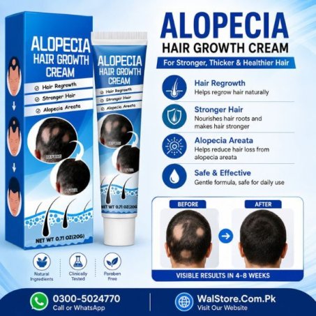 Alopecia Hair Growth Cream Price in Pakistan