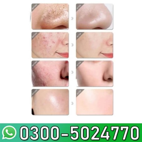 Melona R Serum 30ml In Pakistan
