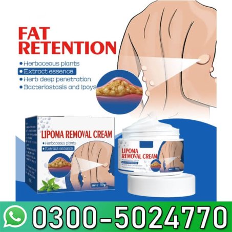 South Moon Lipoma Cream Price in Pakistan