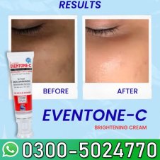  Eventone C Cream Price In Pakistan