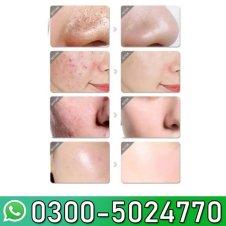  Melona R Serum 30ml In Pakistan