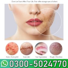  Remove Scars Facial Serum In Pakistan