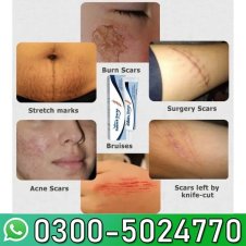  Scar Soothing Cream In Pakistan