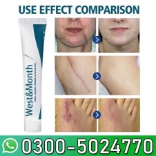  West&month Fade Body Scar Repair Gel In Pakistan